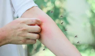 É por causa disto que os mosquitos picam mais algumas pessoas que outras