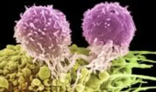 Vacina contra o melanoma: o entusiasmo justifica-se?