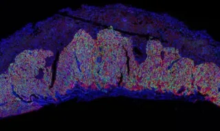 Un estudio revela el papel clave de una proteína en la formación de la placenta y el crecimiento del feto
