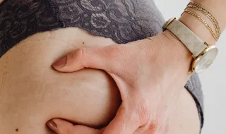 Celulite, flacidez ou falta de volume? O que está por trás de cada queixa no bumbum