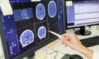 11 anos de quimioterapia depois, descobriu que afinal não tinha o tumor cerebral que lhe diagnosticaram