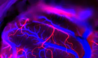 Ensaio clínico vai testar medicamento em pessoas sem sintomas para apurar se é possível prevenir Alzheimer