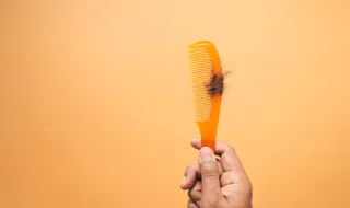 Alopecia: o que pode causar falhas no couro cabeludo, como a relatada por Marciele Albuquerque