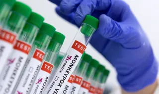 Desde 2025 que está a aumentar transmissão do vírus mpox em Portugal