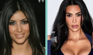 Lembra-se como eram estas celebridades antes das cirurgias plásticas?