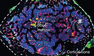 Cientistas de Coimbra descobrem vasos linfáticos nos ossos e reescrevem anatomia